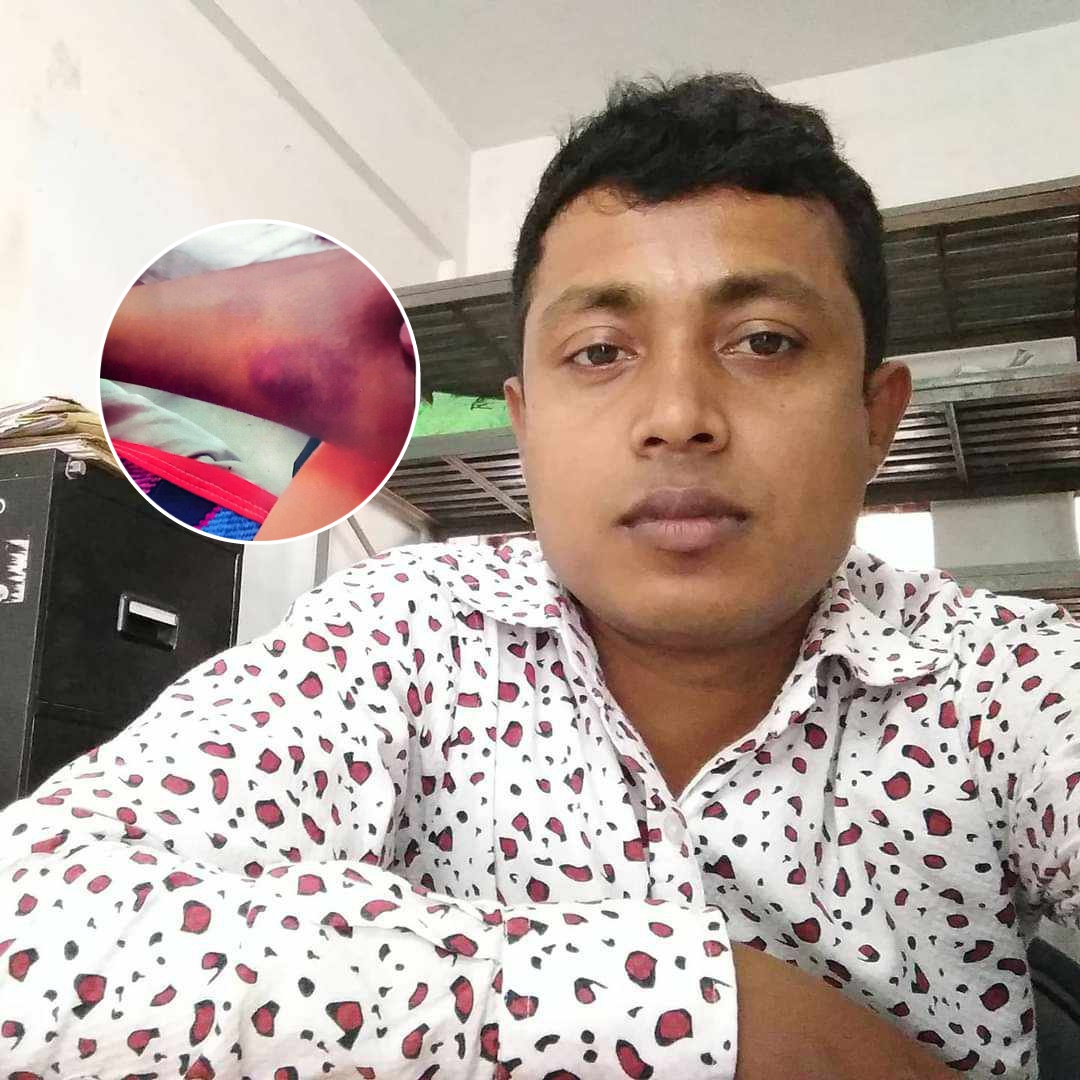 যৌতুকের লোভে নিয়মিতই স্ত্রীকে নির্যাতন মামলা না করার মুচলেকা নেন স্ত্রীর পরিবারের কাছে